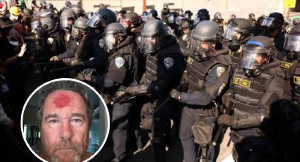 Policía dispara a la cabeza de fotógrafo durante protestas en Los Ángeles | VIDEO