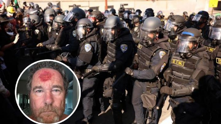 Policía dispara a la cabeza de fotógrafo durante protestas en Los Ángeles | VIDEO