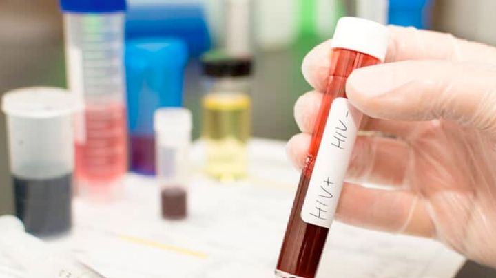 Ofrecen gratis pruebas de detección de HIV; también hay programas de apoyo para vivienda y gastos