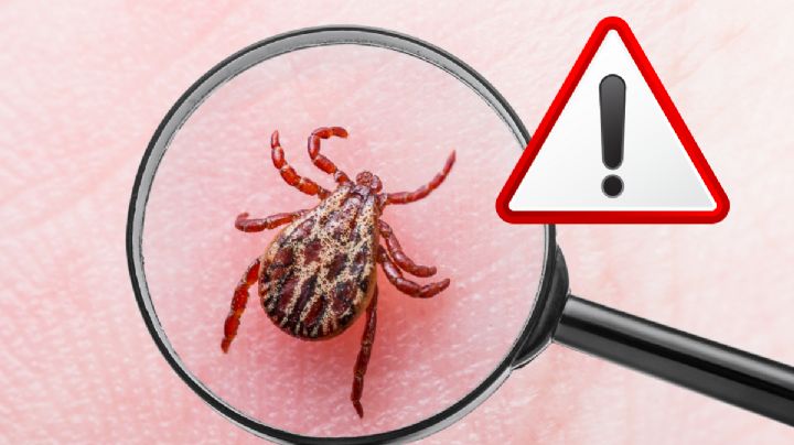 Fallece menor de edad por mordedura de garrapata; es el primer caso del año en Coahuila