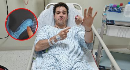Influencer mexicano casi pierde el dedo al probar un producto; se salvó de milagro | VIDEO