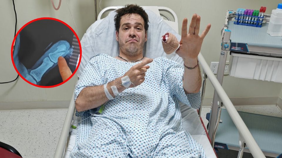 Influencer puso a prueba unas tijeras y 'casi' pierde el dedo