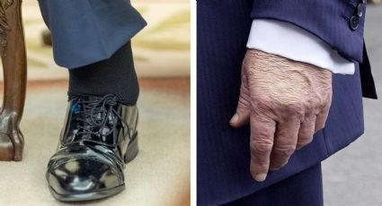 Insuficiencia venosa crónica: ¿es mortal la enfermedad que padece Donald Trump?
