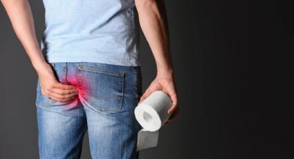 ¿Qué son las hemorroides y cómo eliminarlas de manera natural?