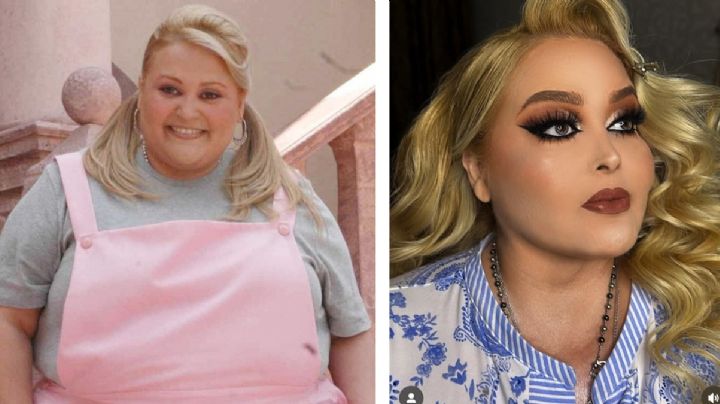 Sheyla se hizo una lipectomía y donó su piel sobrante para niños con quemaduras graves