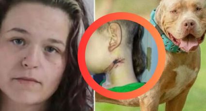 Mujer ató a su hijo de seis años a una silla, y perro casi le arranca la garganta; lo había castigad