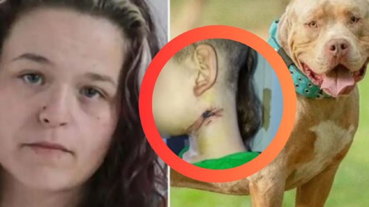 Mujer ató a su hijo de seis años a una silla, y perro casi le arranca la garganta; lo había castigad