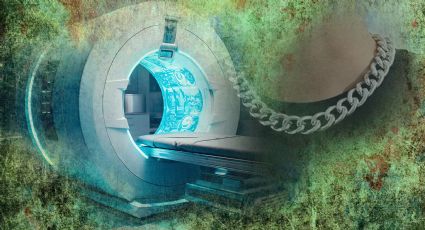 Hombre muere succionado por una máquina de resonancia magnética; olvidó quitarse una cadena