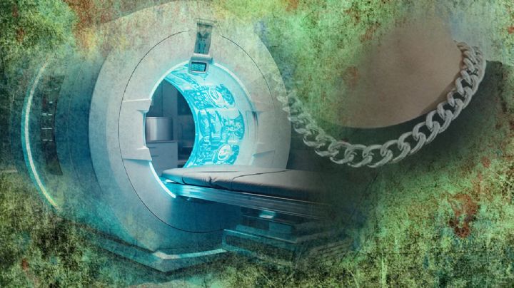 Hombre muere succionado por una máquina de resonancia magnética; olvidó quitarse una cadena