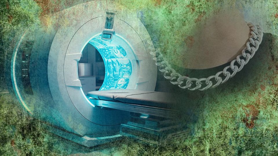Una máquina de resonancia le quita la vida.