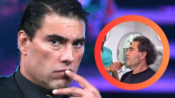 Eduardo Yáñez se somete a tratamiento estético y sorprende con su nuevo rostro rejuvenecido | VIDEO