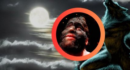El 'hombre lobo' de México: así vive Jesús Aceves con su rara enfermedad