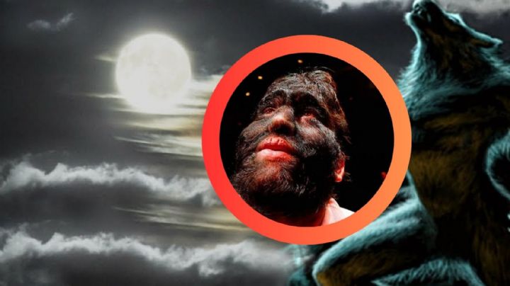 El 'hombre lobo' de México: así vive Jesús Aceves con su rara enfermedad