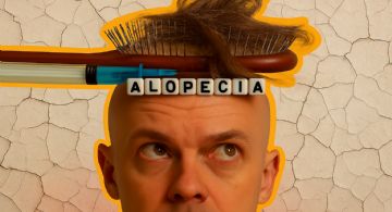 ¿Adiós calvicie?; la vacuna que promete devolver tu melena podría cambiarlo todo