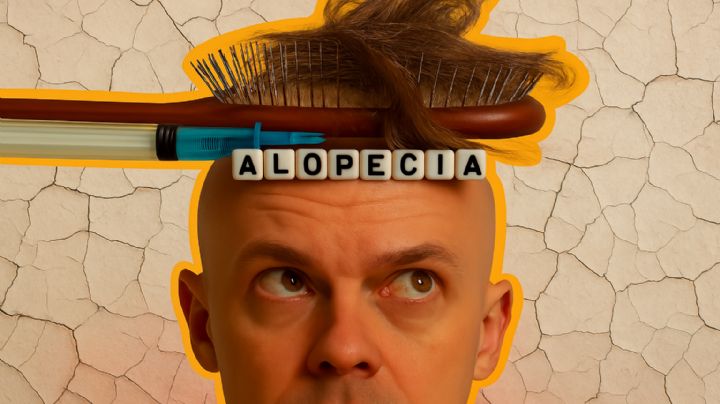 ¿Adiós calvicie?; la vacuna que promete devolver tu melena podría cambiarlo todo