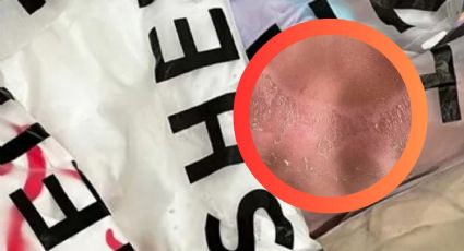 Mujer sufre severas quemaduras tras usar esta prenda de Shein; así respondió la famosa marca