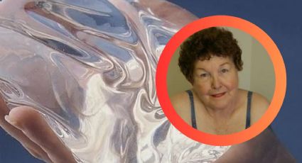 Ella es la primera mujer en ponerse implantes de senos en la historia; aún los lleva 63 años después