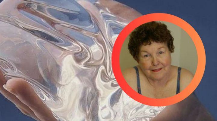 Ella es la primera mujer en ponerse implantes de senos en la historia; aún los lleva 63 años después
