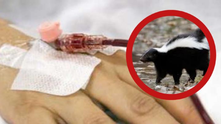 ¿Hay alerta de rabia en humanos en México?, tras el caso de una joven mordida por un zorrillo