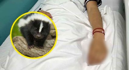 Joven que fue infectada de rabia murió en el hospital; así fueron sus últimos momentos