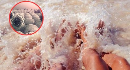 Van seis muertos en este estado por bacteria ‘come carne’; ¿alertan por su forma de contagio?
