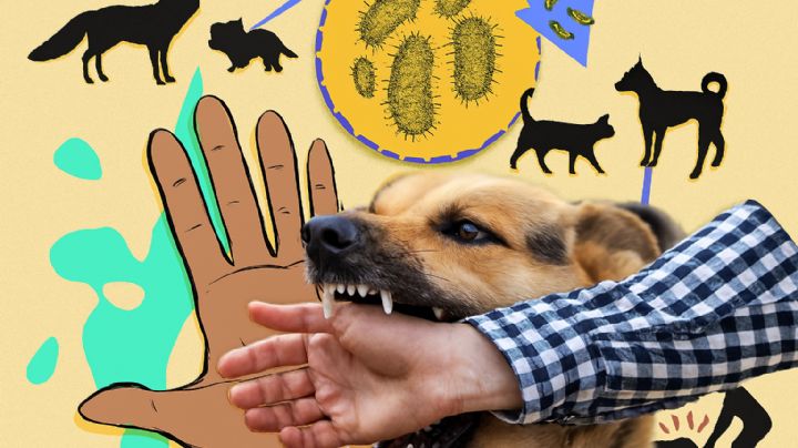 Rabia humana cobra otra víctima en México; hombre fallece tras mordedura de animal