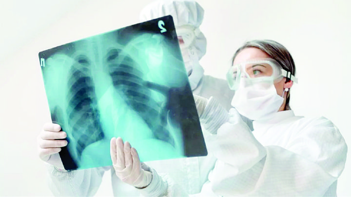 Se disparan casos de tuberculosis en Nuevo Laredo; IMSS Bienestar registra aumento del 30%