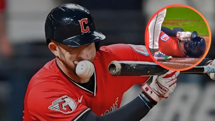 MOMENTO EXACTO en el que beisbolista recibe pelotazo de 160 kilómetros por hora en la cara