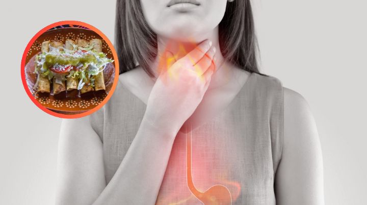 Alimentos comunes  que te destrozarán el esófago si padeces de reflujo o acidez estomacal; ni los pruebes
