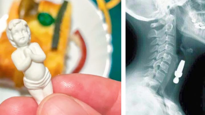 De la rosca de Reyes al hospital: ¿qué tan peligroso es comerse el muñeco para no pagar tamales?