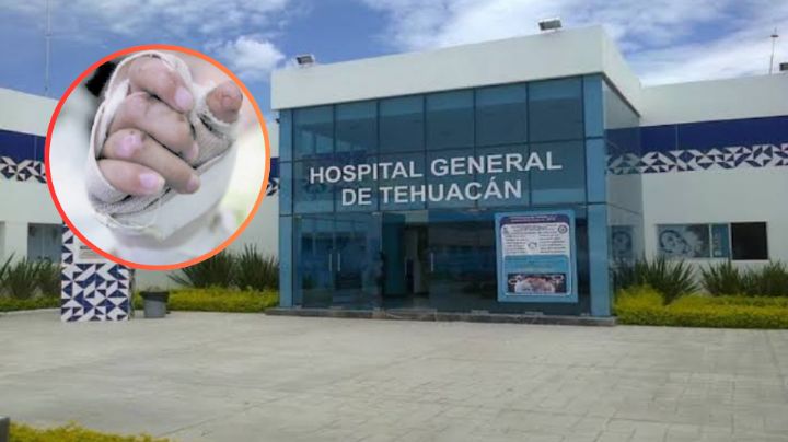 Niño de 5 años cae a olla de agua hirviendo en comunidad de Puebla; se reporta grave