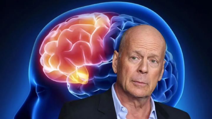 Bruce Willis; ¿qué es la demencia frontotemporal que sufre el actor y cuáles son los síntomas?