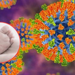 Confirman la muerte de un bebé en Tlaxcala por sarampión; tenía esquema de vacunación incompleto