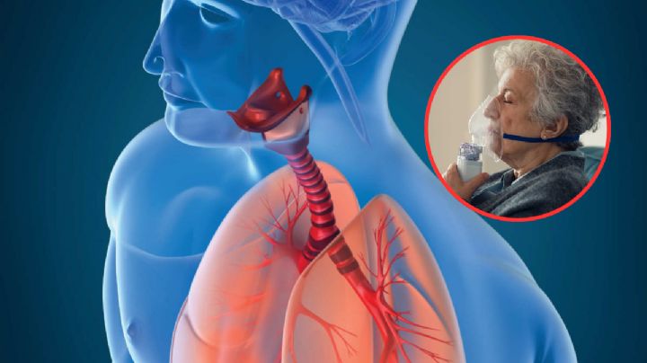 México se enfrenta a otra enfermedad respiratoria mortal además del sarampión; avanza rápidamente