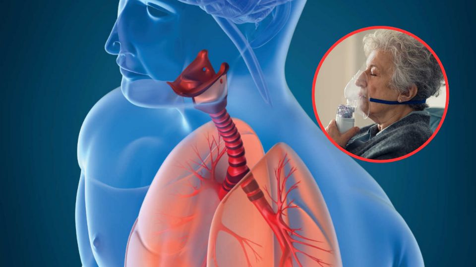 La Organización Panamericana de la Salud afirma que la enfermedad se manifiesta principalmente con tos persistente, que puede acompañarse de flemas o incluso sangre.