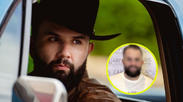 Carín León sorprende a sus fans al someterse a un trasplante capilar