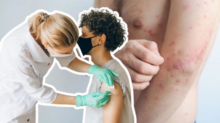 Sarampión en México: este es el grupo que tendrá preferencia para vacunarse