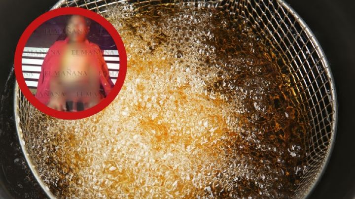 Fallece abuelito velador en el Hospital General; aceite hirviendo le quemó 60% del cuerpo