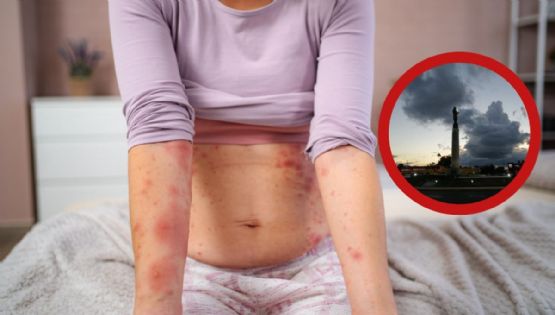 ¿Hay casos de sarampión en Nuevo Laredo?; esta es la versión oficial de la Secretaría de Salud de Tamaulipas