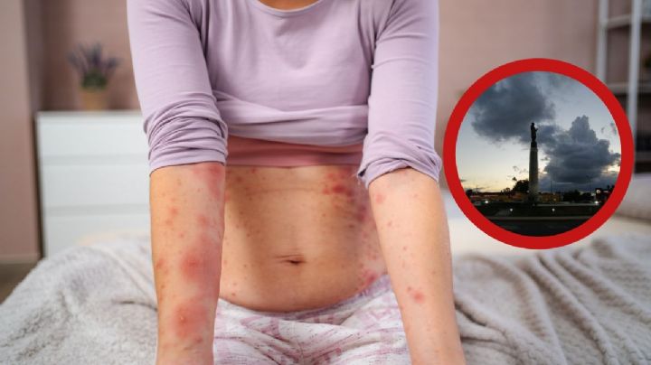 ¿Hay casos de sarampión en Nuevo Laredo?; esta es la versión oficial de la Secretaría de Salud de Tamaulipas