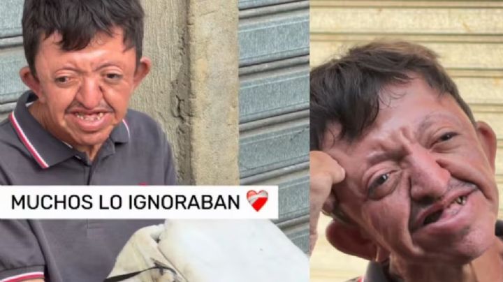 'Todas las noches lloro por mis padres': vendedor ambulante con discapacidad revela su lucha diaria | VIDEO