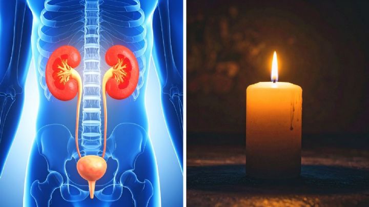 Mueren 53 personas en Nuevo Laredo esperando trasplante de riñón; 500 pacientes siguen a la espera