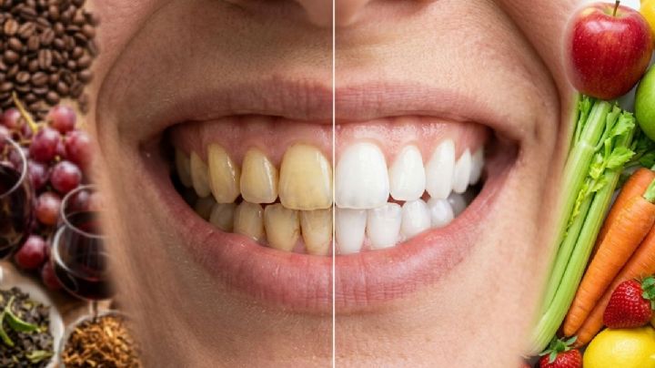 Blanqueamiento natural: ¿Qué alimentos debes comer para tener dientes más claros y esmalte fuerte?