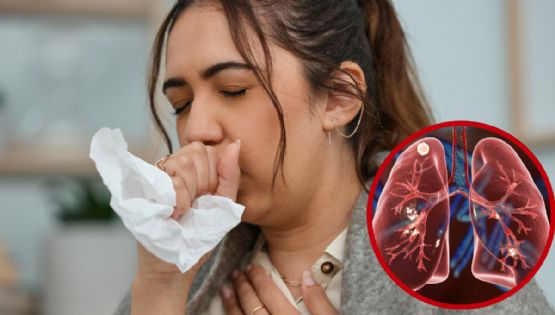 Intensifican vigilancia en Nuevo Laredo por tuberculosis