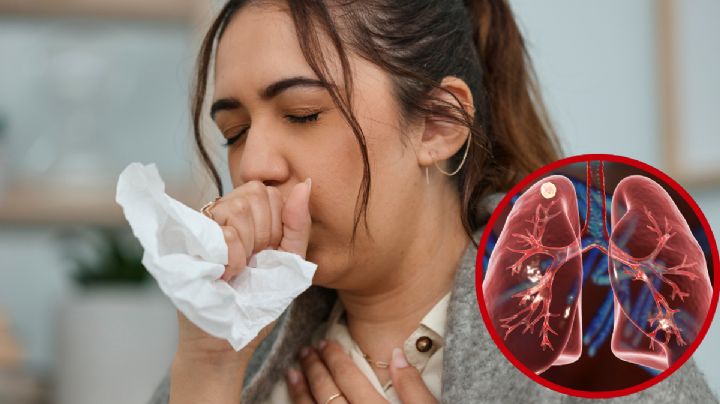 Intensifican vigilancia en Nuevo Laredo por tuberculosis