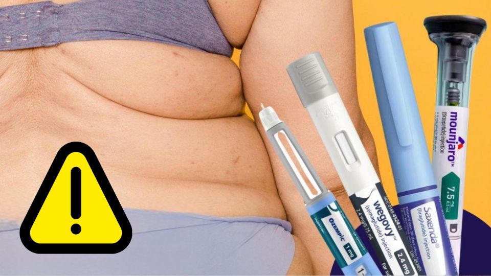 Estas inyecciones no está indicado para personas sin diabetes o sobrepeso moderado
