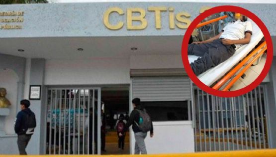 Alumno del CBTis es agredido al salir de clases; ya lo habían amenazado