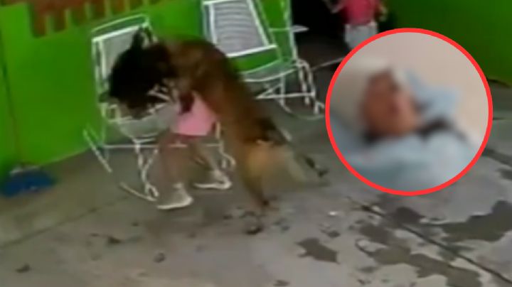 Perro familiar ataca brutalmente a niña de 7 años en Coahuila; recibió 68 puntadas en la cabeza  | VIDEO