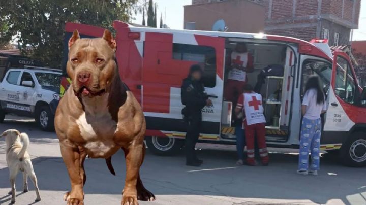 Mujer es mordida por su mascota, un perro pitbull, en Celaya; ya había atacado anteriormente