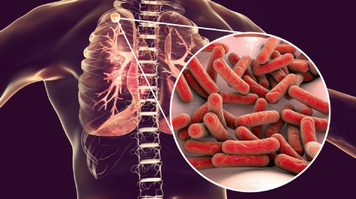 Hospital General de Nuevo Laredo advierte repunte de tuberculosis; pacientes llegan con complicaciones graves